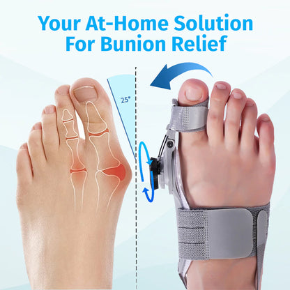 Bunion Corrector - Adjustable ToeAlignment Support for Daily Comfort-AFF