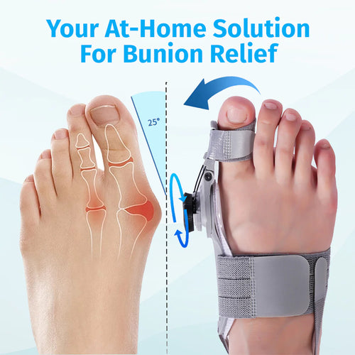 Bunion Corrector - Adjustable ToeAlignment Support for Daily Comfort-AFF