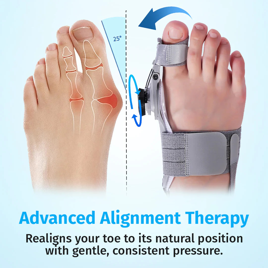 Bunion Corrector - Adjustable ToeAlignment Support for Daily Comfort-AFF