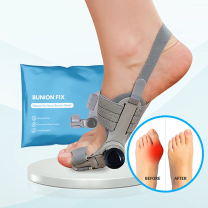 Bunion Corrector - Adjustable ToeAlignment Support for Daily Comfort-AFF